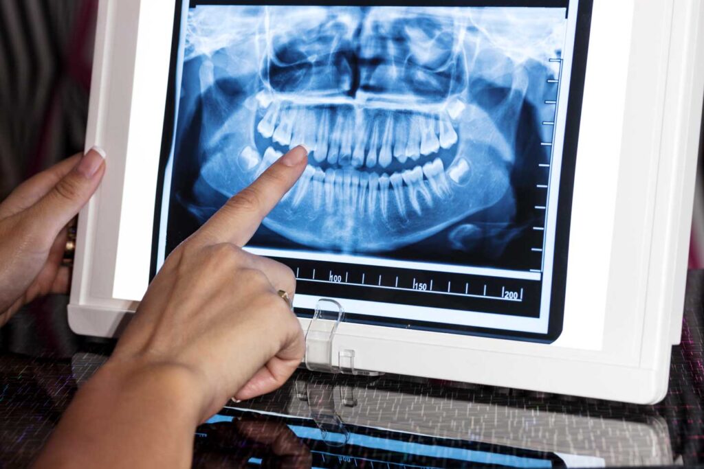 tratamientos con Radiografía dental en optima dental