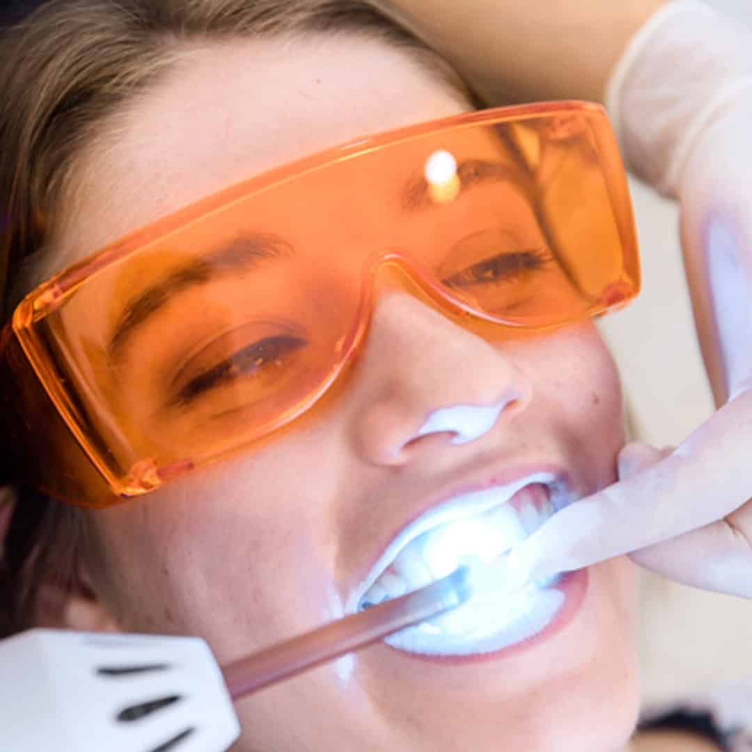 Tratamientos-óptima-dental